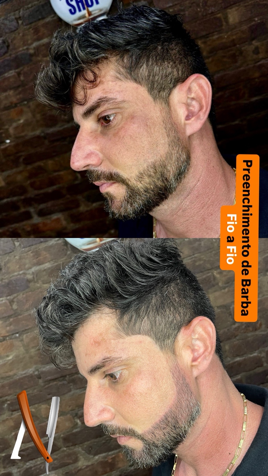 Barba fio a fio - caso 1