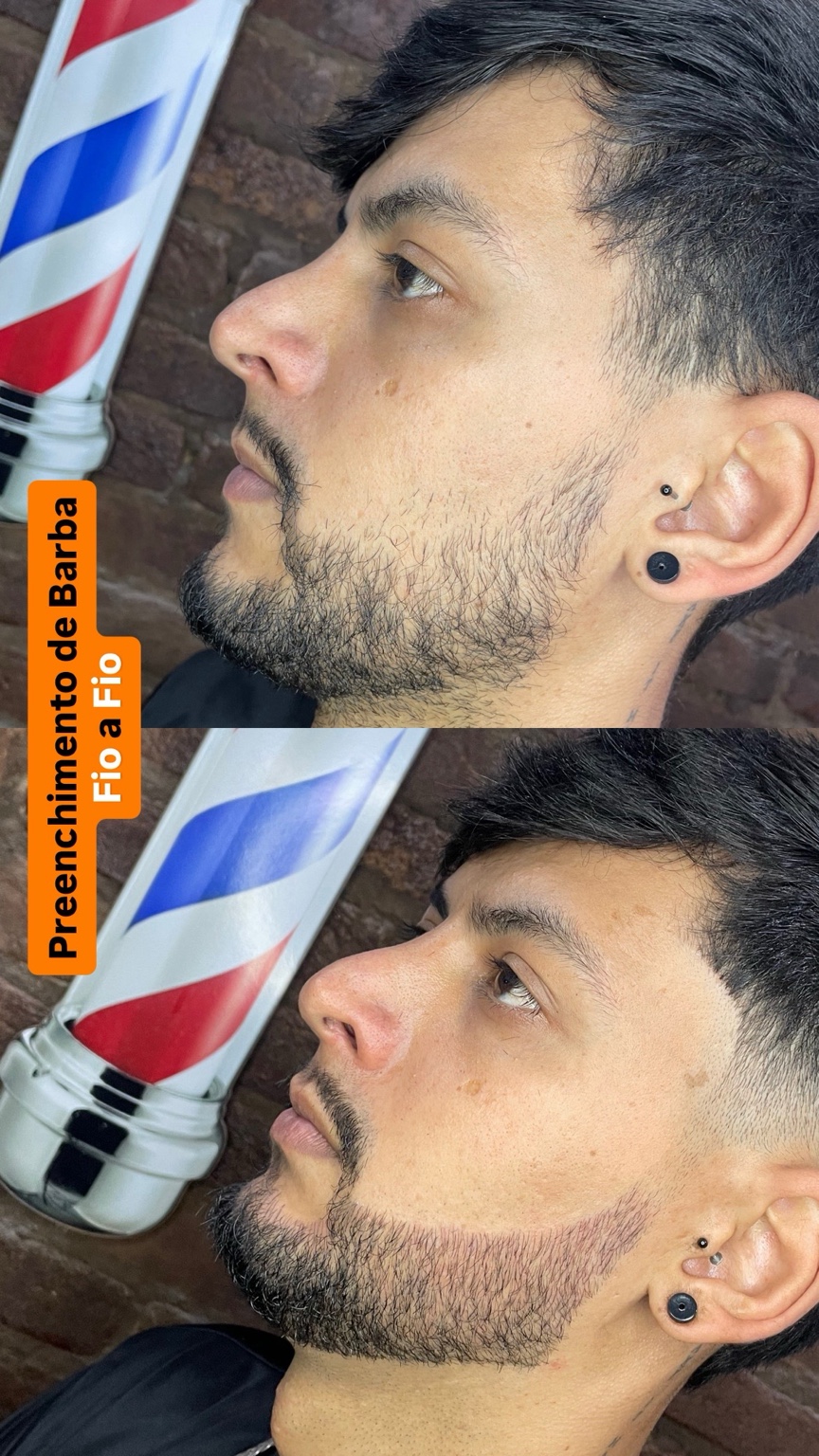 Barba fio a fio - caso 2